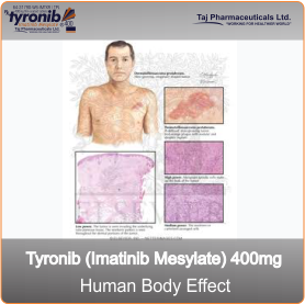 Chronic myeloid leukaemia